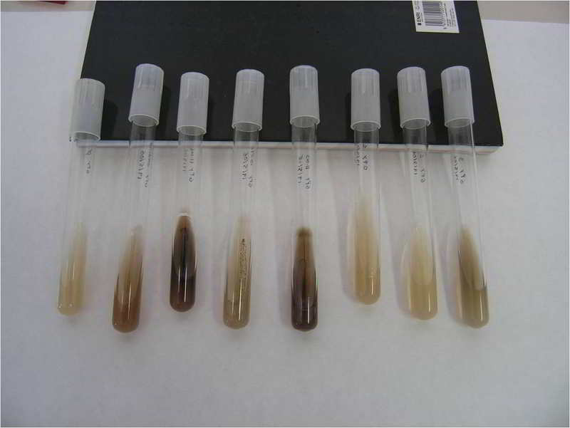 Fotografía 1. Determinación de actividad β-glucosidasa en levaduras revelada por la pigmentación marrón del medio. © Rosa Pando. SERIDA 2011.