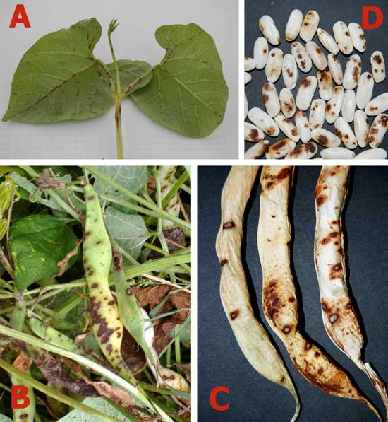 Síntomas característicos de la antracnosis de la judía en hoja (A), vainas (B y C) y semilla (D) de faba granja asturiana