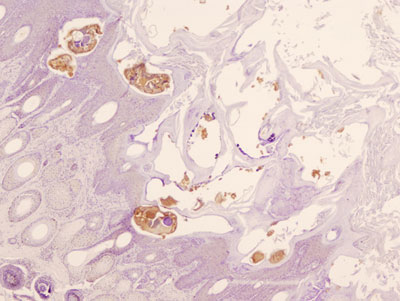 Tinción inmunohistoquímica de ácaros de S. scabiei en piel de rebeco (PAP, X40).