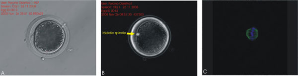 Figura 1. Ovocitos porcinos madurados in vitro evaluados por A) microscopia convencional, B) microscopia de luz polarizada, C) inmunocitoquímica del huso meiótico-microscopia confocal