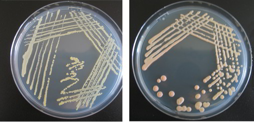 Figura 1. A la izquierda, curtobacterium flaccumfaciens, a la derecha, Kocuria sp